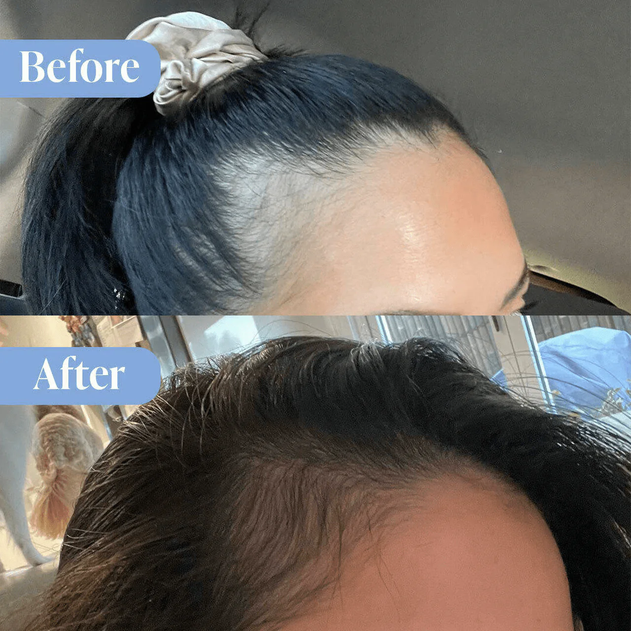 Anti-Hair Loss Shampoo & Conditioner Bundle - Image 5
