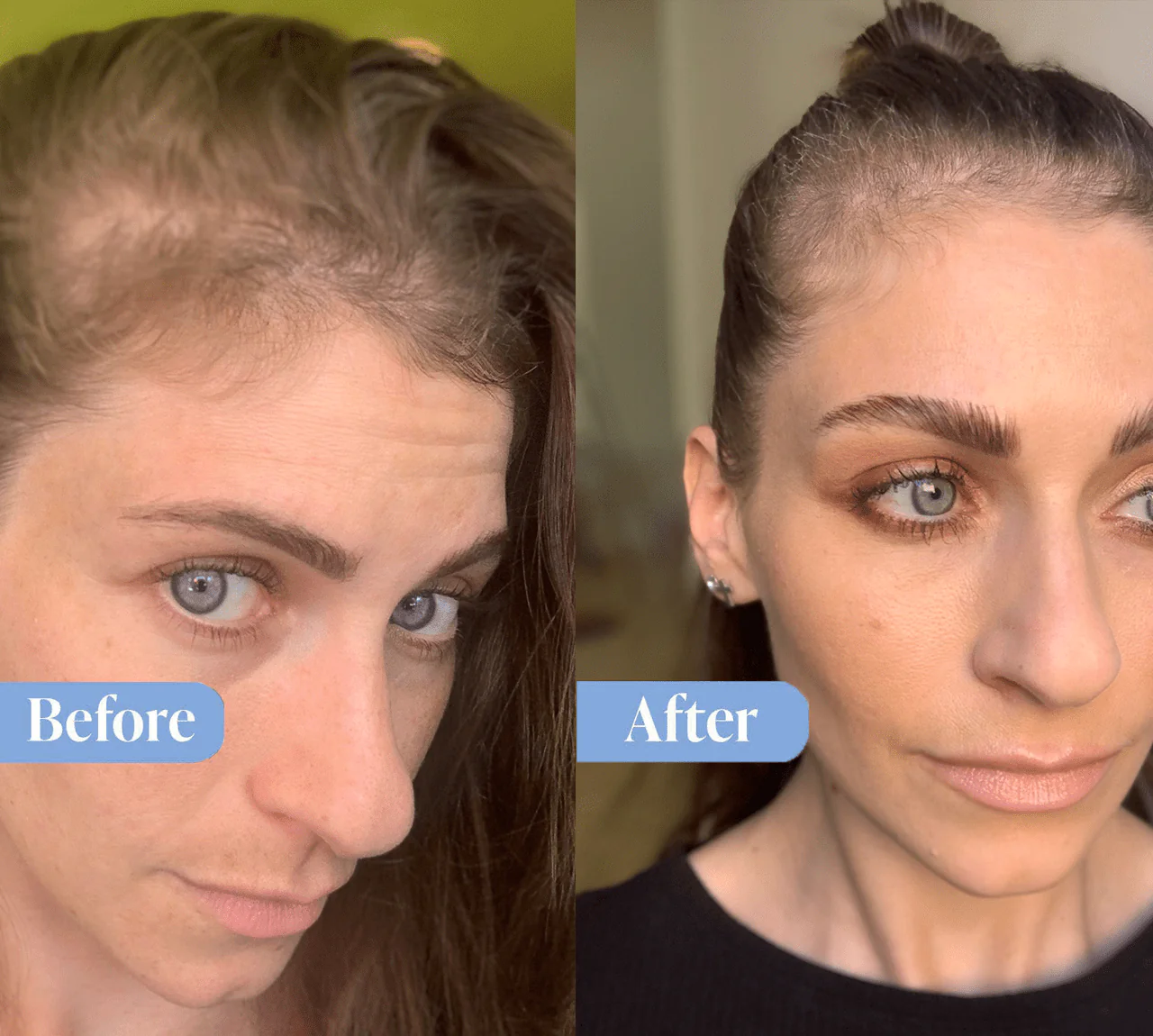 Anti-Hair Loss Repair Bundle (Free Conditioner Included) - Image 3
